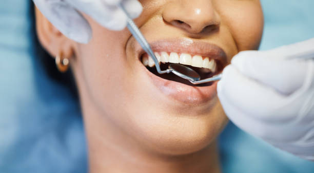 Best Emergency Broken Tooth Repair in Berlin, OH